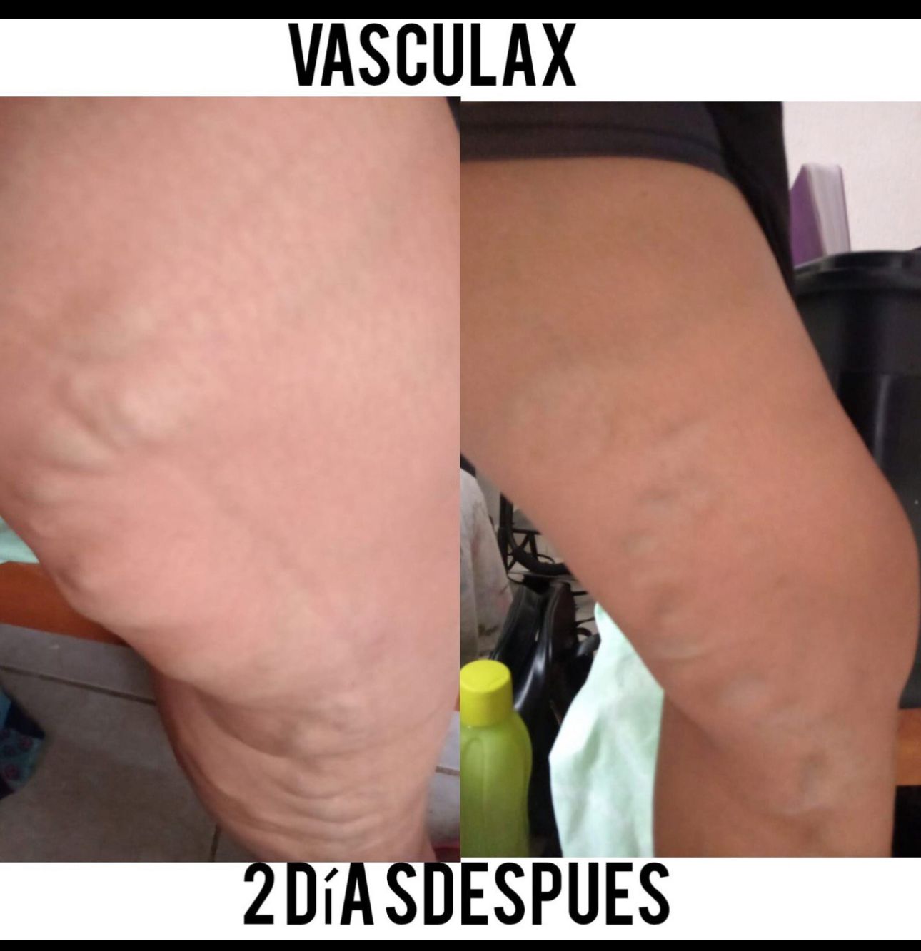 Antes y después 2 días